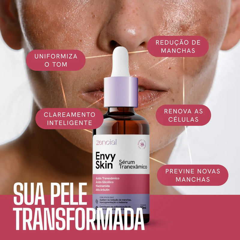 Sérum Envy Skin 30ml – Clareador com Ácido Tranexâmico para Manchas e Melasma