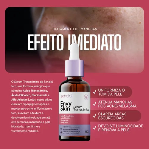 Sérum Envy Skin 30ml – Clareador com Ácido Tranexâmico para Manchas e Melasma