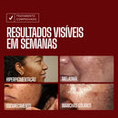 Sérum Envy Skin 30ml – Clareador com Ácido Tranexâmico para Manchas e Melasma