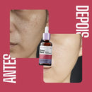 Sérum Envy Skin 30ml – Clareador com Ácido Tranexâmico para Manchas e Melasma