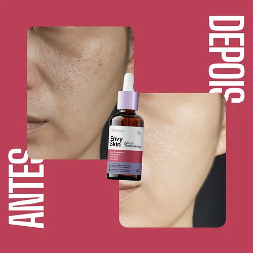 Sérum Envy Skin 30ml – Clareador com Ácido Tranexâmico para Manchas e Melasma