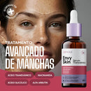 Sérum Envy Skin 30ml – Clareador com Ácido Tranexâmico para Manchas e Melasma